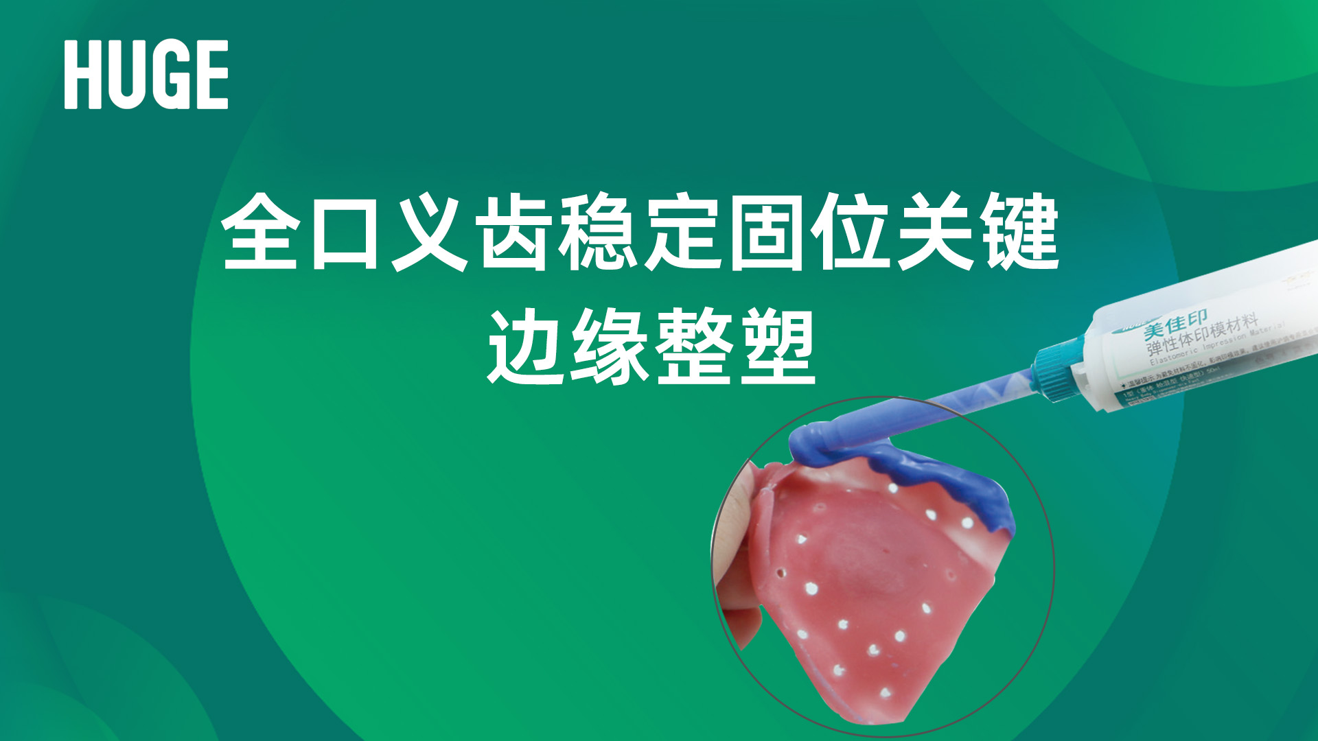 用美佳印枪混1型做全口义齿边缘整塑：一次成型，操作更便捷！