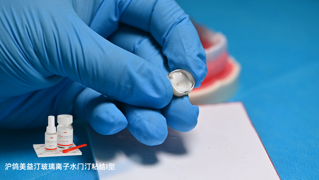 沪鸽美益汀玻璃离子水门汀粘结I型 | 用于烤瓷牙粘结操作流程