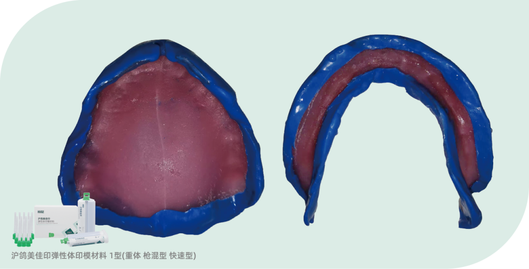 沪鸽美佳印弹性体印模材料 | 全口义齿终印模制取流程