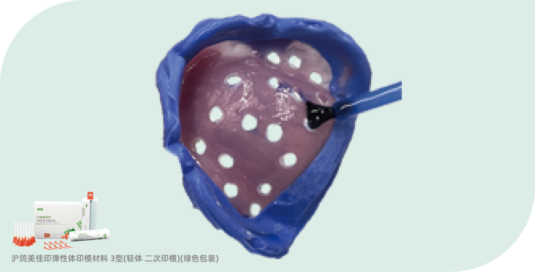 沪鸽美佳印弹性体印模材料 | 全口义齿终印模制取流程