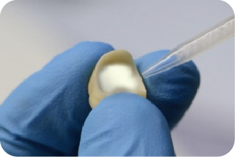 沪鸽美益汀自粘接树脂水门汀 | 用于种植一体冠、纤维桩、氧化锆冠的粘接流程